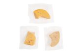 Foie Gras Slices